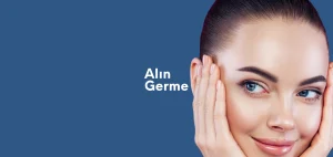 Alın Germe