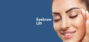 Eyebrow Lift