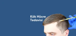 Kök Hücre Tedavisi
