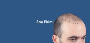 MP FUE Saç Ekimi