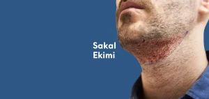 Sakal Ekimi